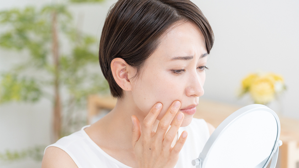 <今日は何の日>5月21日『ニキビの日』